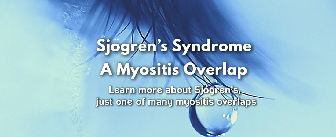 Sjogrens-syndrome, a Myositis overlap