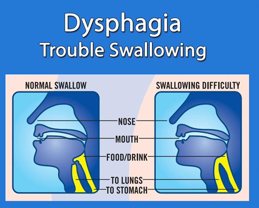 Thick-It  Dysphagia and Swallowing Disorder Nutrition
