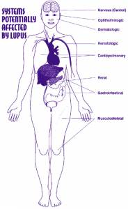 Organs and systems affected by Lupus