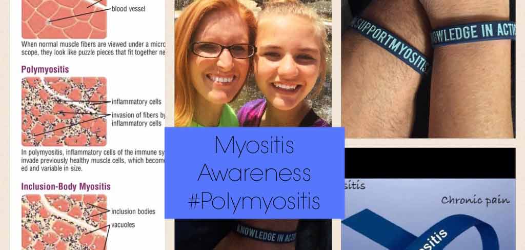 Just a little collage to raise awareness. #polymyositis