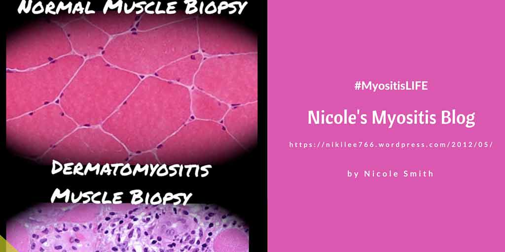 Nicole's Myositis Blog